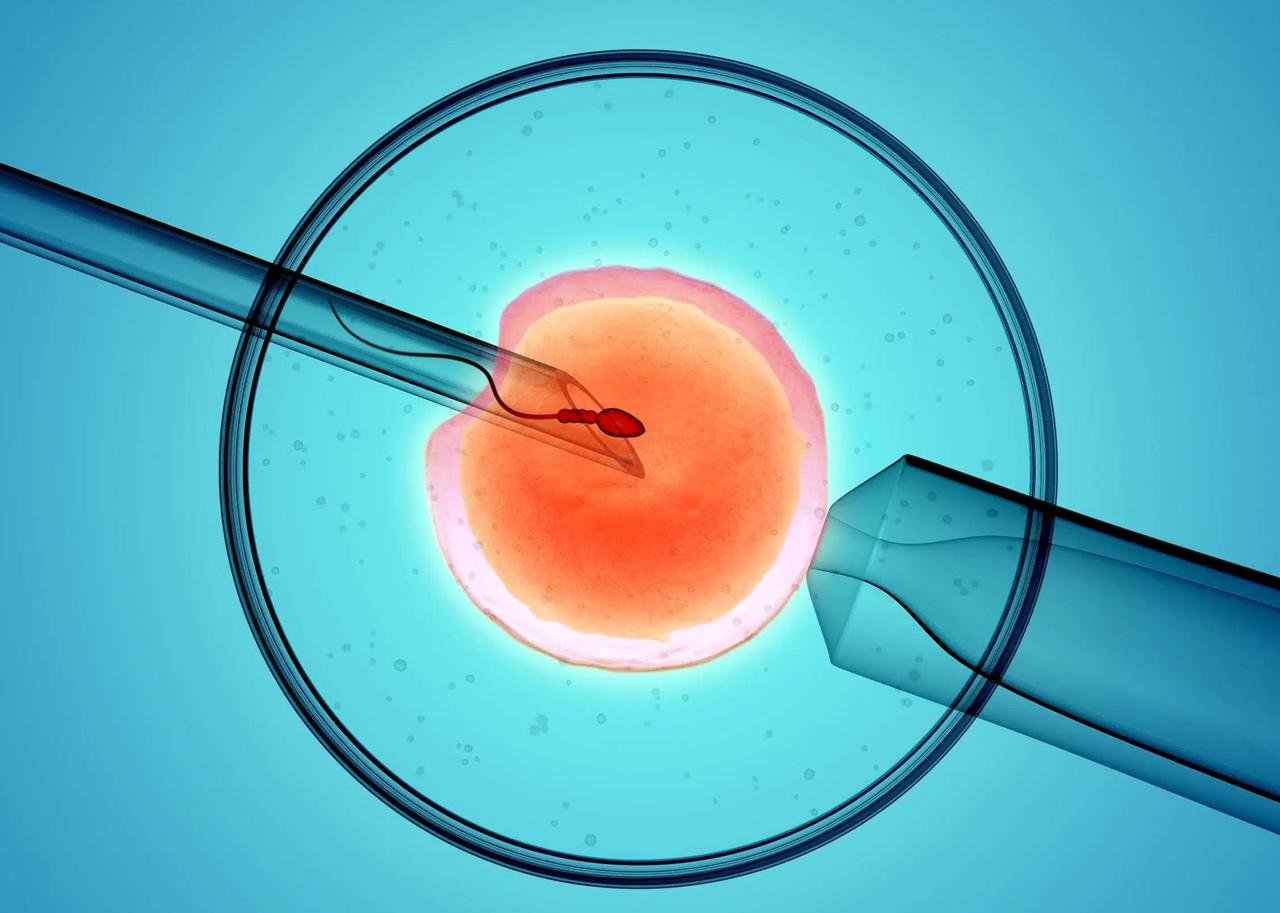 Here’s everything you need to know about In Vitro Fertilization