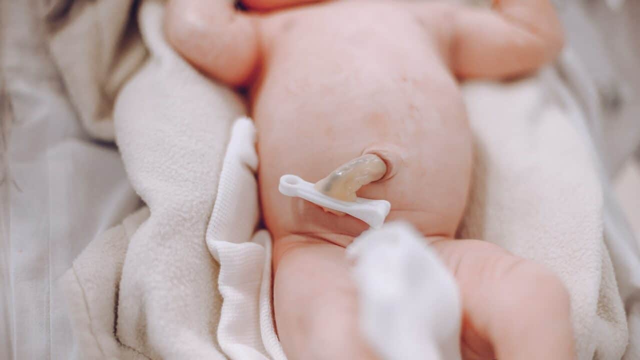 Steps to manage your baby’s umbilical cord