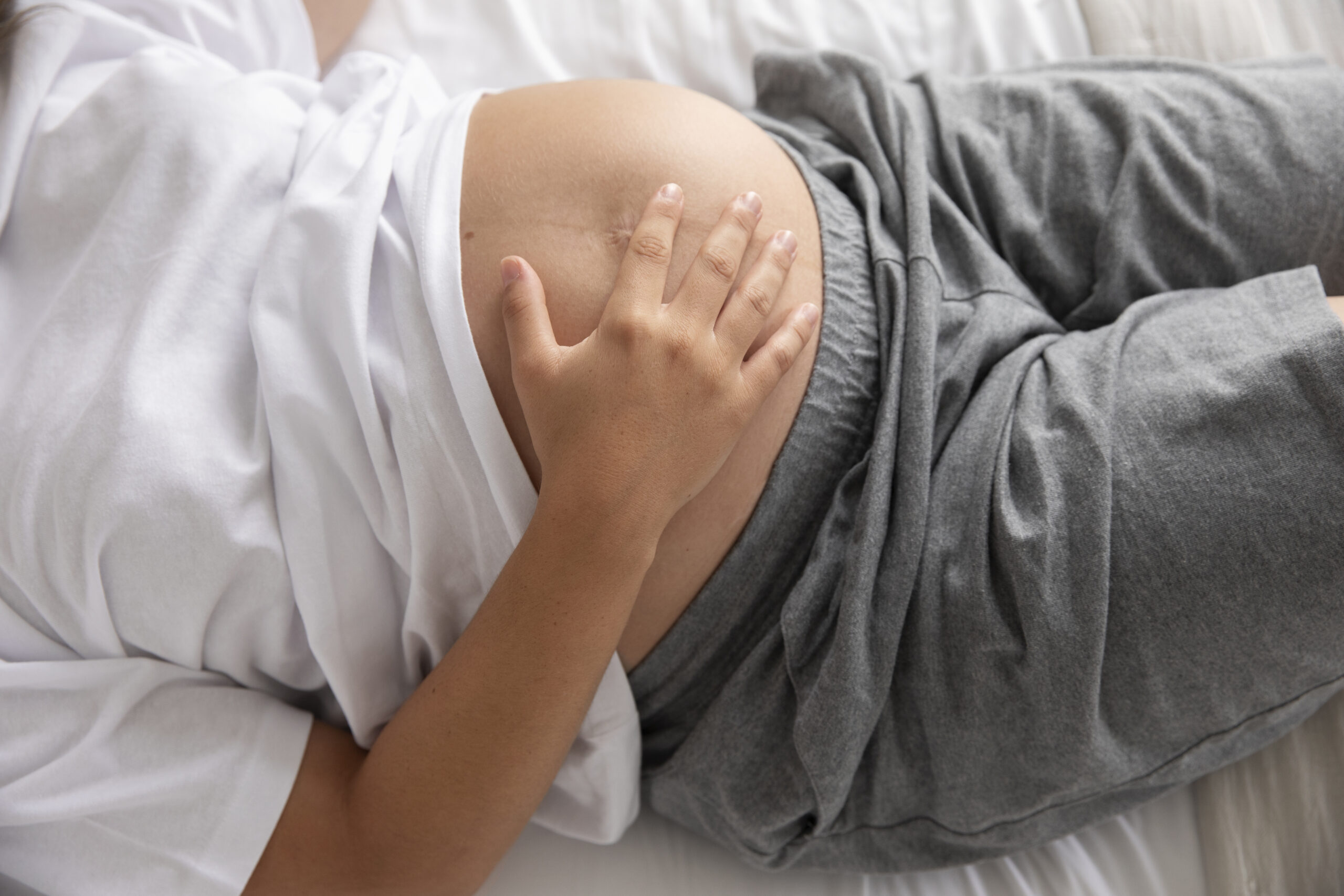 Round Ligament Pain During Pregnancy: What It Is and How to Manage It