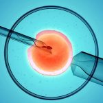 Here’s everything you need to know about In Vitro Fertilization